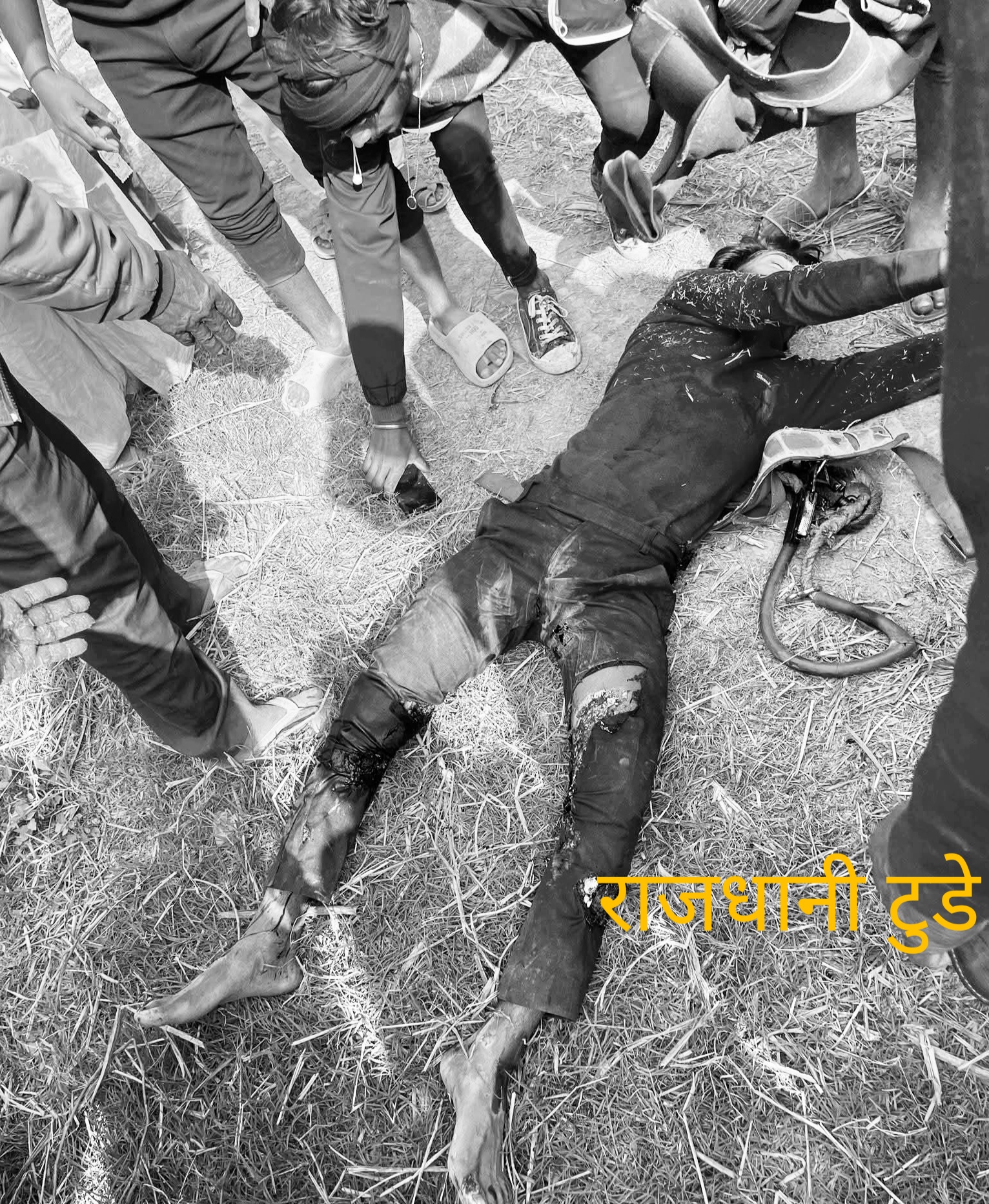 गौशला–१२ मा बिजुलीको पोलमा काम गर्ने युवकलाई करेन्ट लाग्दा घाइते, थप उपचारको लागि काठमाण्डौँ पठाइयो